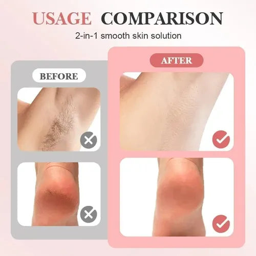 Quita Callos y Depilador