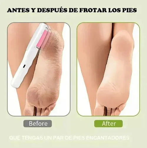 Quita Callos y Depilador